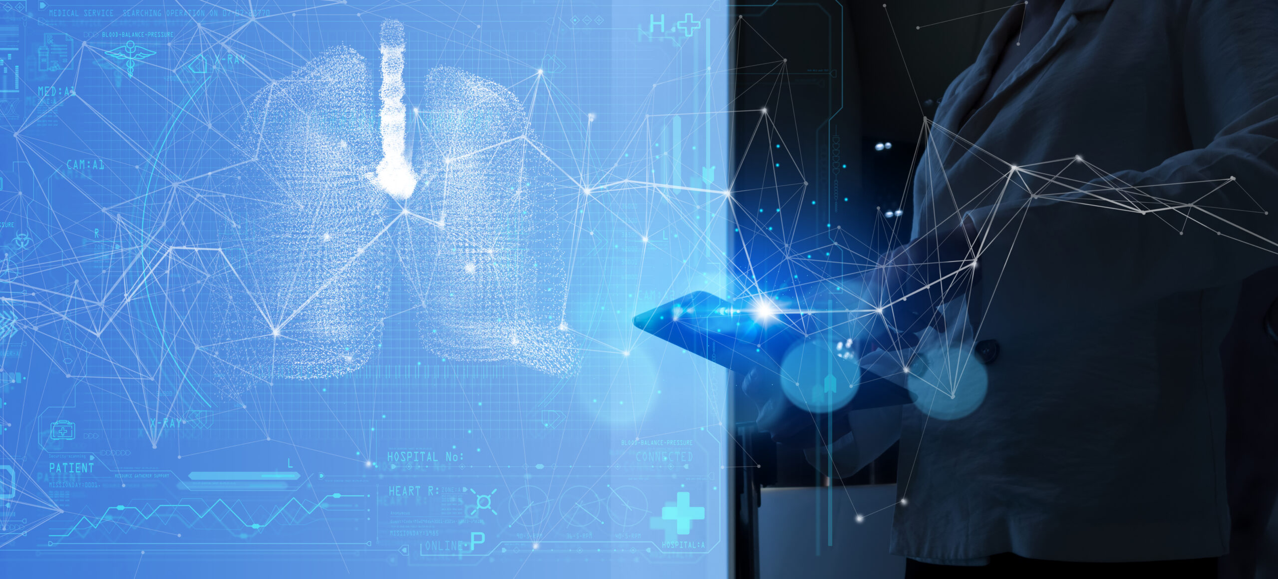 IDOR desenvolve ferramentas de Inteligência Artificial para diagnóstico de doenças pulmonares