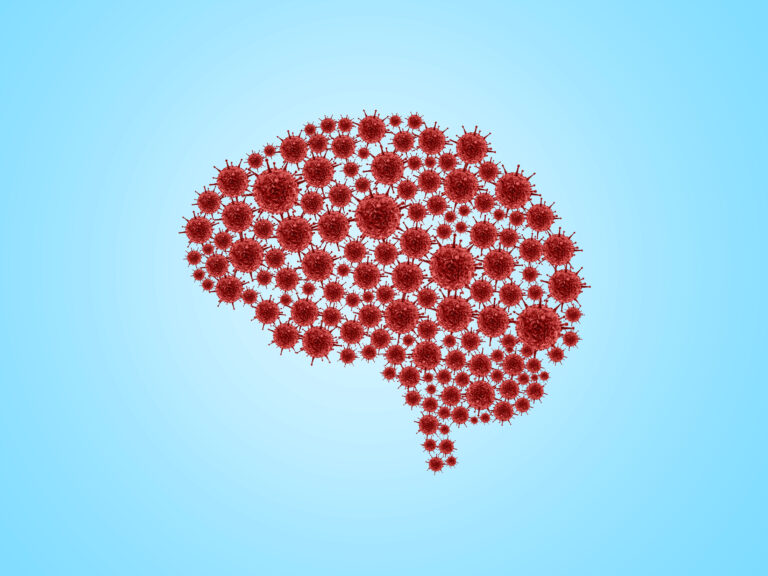 Depressão e neuroinflamação persistente podem estar relacionadas à disfunção cognitiva observada na covid longa