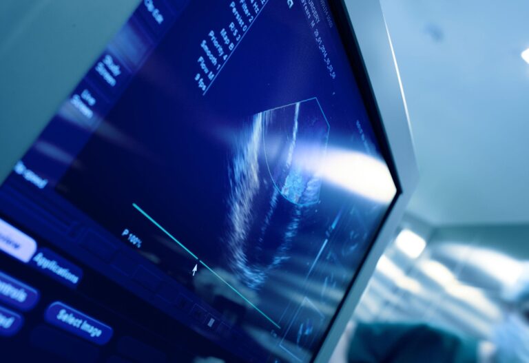 IDOR na Mídia: Pesquisa brasileira aponta novos alvos terapêuticos para fibrilação atrial