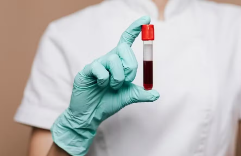 imagem de O Globo | Exame de sangue para Alzheimer avança na detecção precoce
